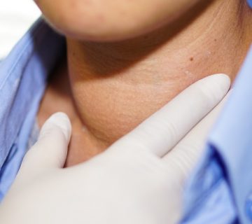 Cáncer de tiroides cirugía Dra Monserrath Acosta