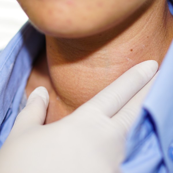 Cáncer de tiroides cirugía Dra Monserrath Acosta