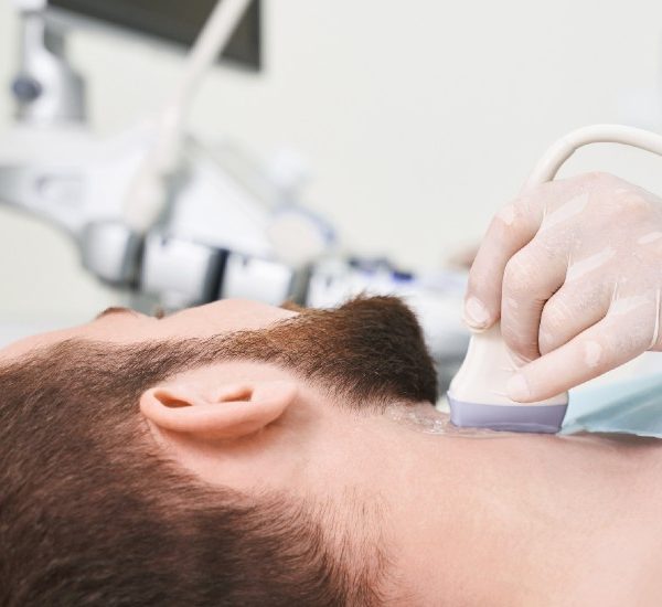 Nodo cervical ganglios extirpación Dra. Monserrat Acosta