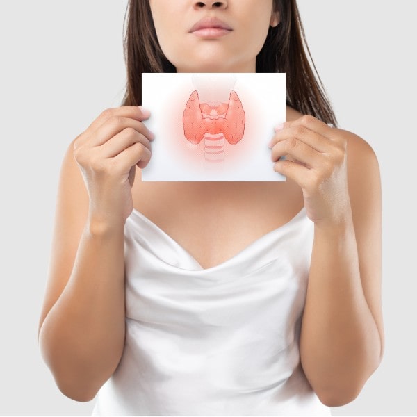 Nódulos tiroideos Dra. Monserrat Acosta