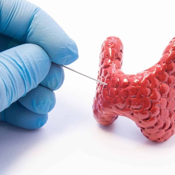 Punción tiroides Dra. Monserrat Acosta