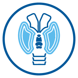 Hipotiroidismo Hipotiroidismo