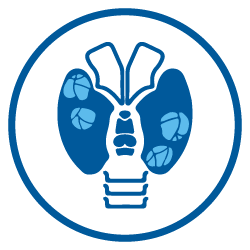 Cancer Tiroides Cancer Tiroides