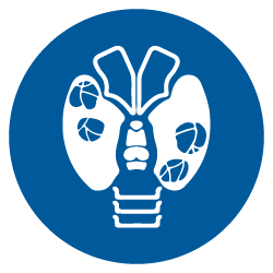 Cancer Tiroides Cancer Tiroides